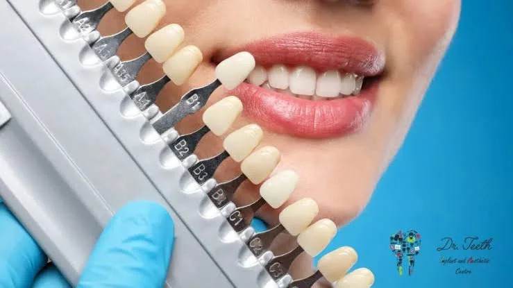 Need a Cosmetic Dental Service? Simple Treatments Explained